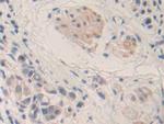 MMP24 Antibody in Immunohistochemistry (Paraffin) (IHC (P))