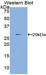 MMP24 Antibody in Western Blot (WB)