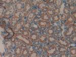 MMP9 Antibody in Immunohistochemistry (Paraffin) (IHC (P))