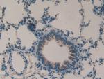 MMP9 Antibody in Immunohistochemistry (Paraffin) (IHC (P))