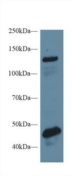 Mgea5 Antibody in Western Blot (WB)