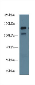 Mgea5 Antibody in Western Blot (WB)