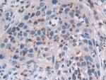 MAT2A Antibody in Immunohistochemistry (Paraffin) (IHC (P))