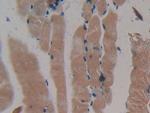 MYH2 Antibody in Immunohistochemistry (Paraffin) (IHC (P))