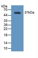 MYH2 Antibody in Western Blot (WB)