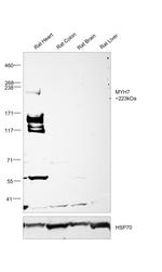 MYH7 Antibody in Western Blot (WB)