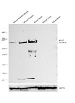 MYH7 Antibody in Western Blot (WB)