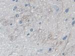 MYO1D Antibody in Immunohistochemistry (Paraffin) (IHC (P))