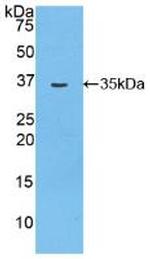 MYO1D Antibody in Western Blot (WB)