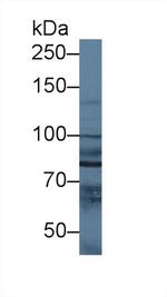 NAGLU Antibody in Western Blot (WB)