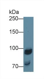 NAGLU Antibody in Western Blot (WB)