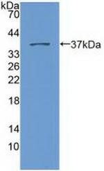 Nesprin 2 Antibody in Western Blot (WB)