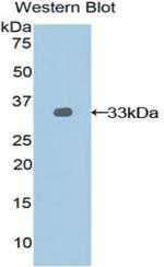 Nexilin Antibody in Western Blot (WB)