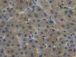 NNMT Antibody in Immunohistochemistry (Paraffin) (IHC (P))