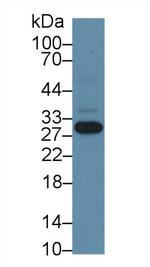 NNMT Antibody in Western Blot (WB)