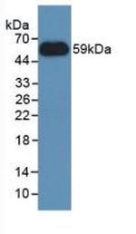 NNMT Antibody in Western Blot (WB)