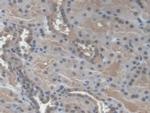 NME3 Antibody in Immunohistochemistry (Paraffin) (IHC (P))