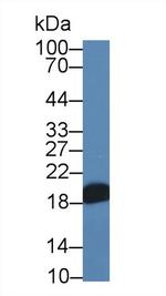 NME3 Antibody in Western Blot (WB)