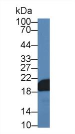 NME3 Antibody in Western Blot (WB)