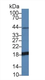 NME3 Antibody in Western Blot (WB)