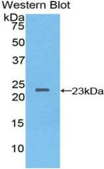 NME3 Antibody in Western Blot (WB)