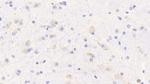 OPHN1 Antibody in Immunohistochemistry (Paraffin) (IHC (P))