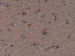 PAK1 Antibody in Immunohistochemistry (Paraffin) (IHC (P))