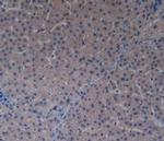 PAK1 Antibody in Immunohistochemistry (Paraffin) (IHC (P))