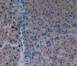 PAK1 Antibody in Immunohistochemistry (Paraffin) (IHC (P))