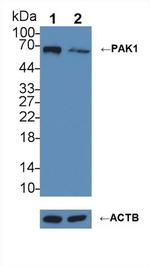 PAK1 Antibody in Western Blot (WB)
