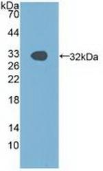 PAK1 Antibody in Western Blot (WB)