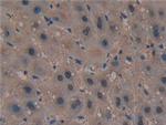 PAK2 Antibody in Immunohistochemistry (Paraffin) (IHC (P))