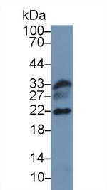 DJ-1 Antibody in Western Blot (WB)