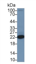 DJ-1 Antibody in Western Blot (WB)