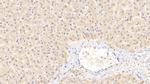 PEX2 Antibody in Immunohistochemistry (Paraffin) (IHC (P))