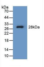 PAH Antibody in Western Blot (WB)