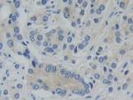 PFKP Antibody in Immunohistochemistry (Paraffin) (IHC (P))