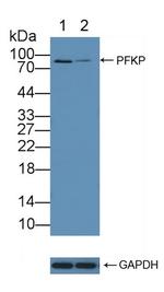 PFKP Antibody in Western Blot (WB)