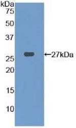 PFKP Antibody in Western Blot (WB)