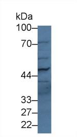 PLB1 Antibody in Western Blot (WB)