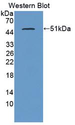 PLB1 Antibody in Western Blot (WB)