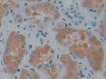 PSAT1 Antibody in Immunohistochemistry (Paraffin) (IHC (P))