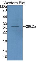 PAFAH1B3 Antibody in Western Blot (WB)