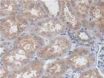 PCYOX1 Antibody in Immunohistochemistry (Paraffin) (IHC (P))