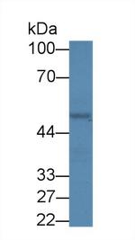 PCYOX1 Antibody in Western Blot (WB)