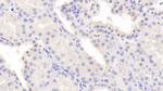 PDCD6 Antibody in Immunohistochemistry (Paraffin) (IHC (P))