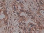 PRCP Antibody in Immunohistochemistry (Paraffin) (IHC (P))