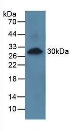 PRCP Antibody in Western Blot (WB)