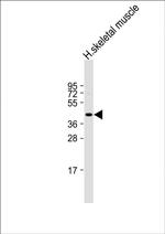 Myostatin Antibody in Western Blot (WB)