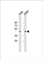 Myostatin Antibody in Western Blot (WB)